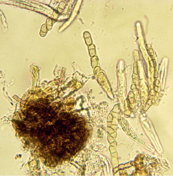 Плодовое тело парши яблони с асками и аскоспорами