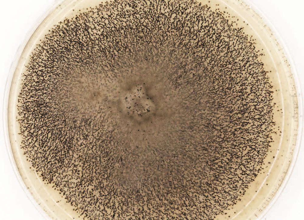 Возбудитель антракноза сои Colletotrichum truncatum в лаборатории НИЦ Возбудитель антракноза сои Colletotrichum truncatum в лаборатории НИЦ