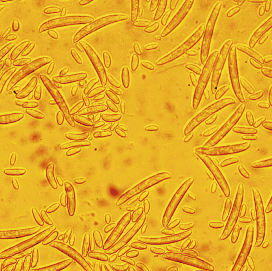 Фузариоз колоса: что делать?